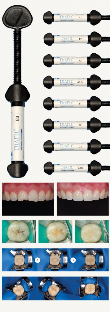 DiaFil  A3.5  �������� ��������� �����������  1 �����4� 