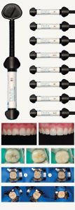 DiaFil  A3.5  �������� ��������� �����������  1 �����4� 