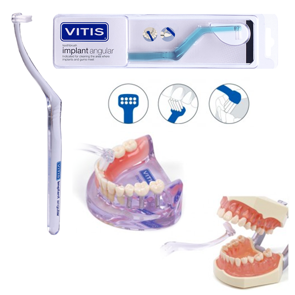 ������ ����� VITIS� Implant Angular